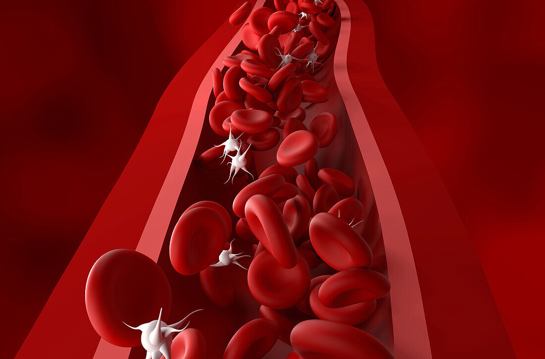 Thrombocytopaenia, illustration