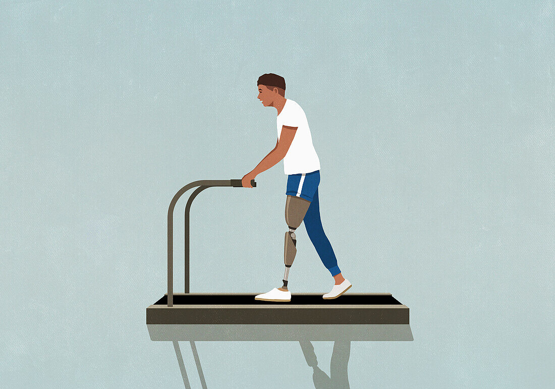 Amputierter Mann mit Beinprothese trainiert, geht auf dem Laufband