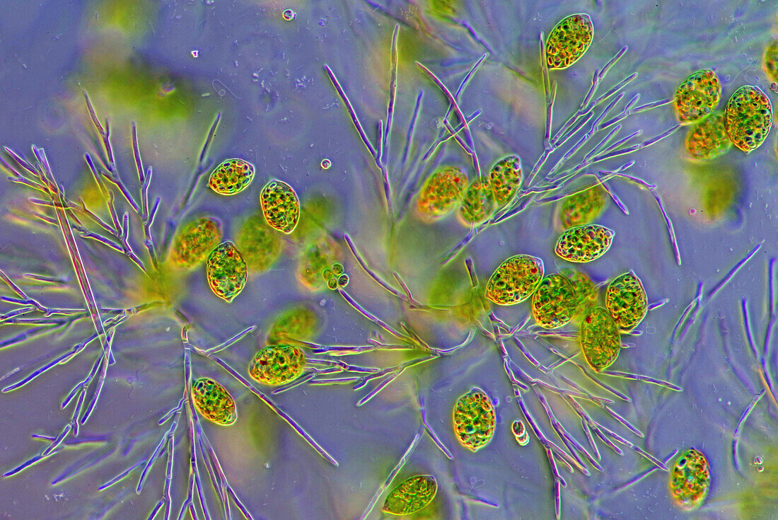 The image presents euglenoids among green algae, photographed through the microscope in polarized light at a magnification of 100X\n