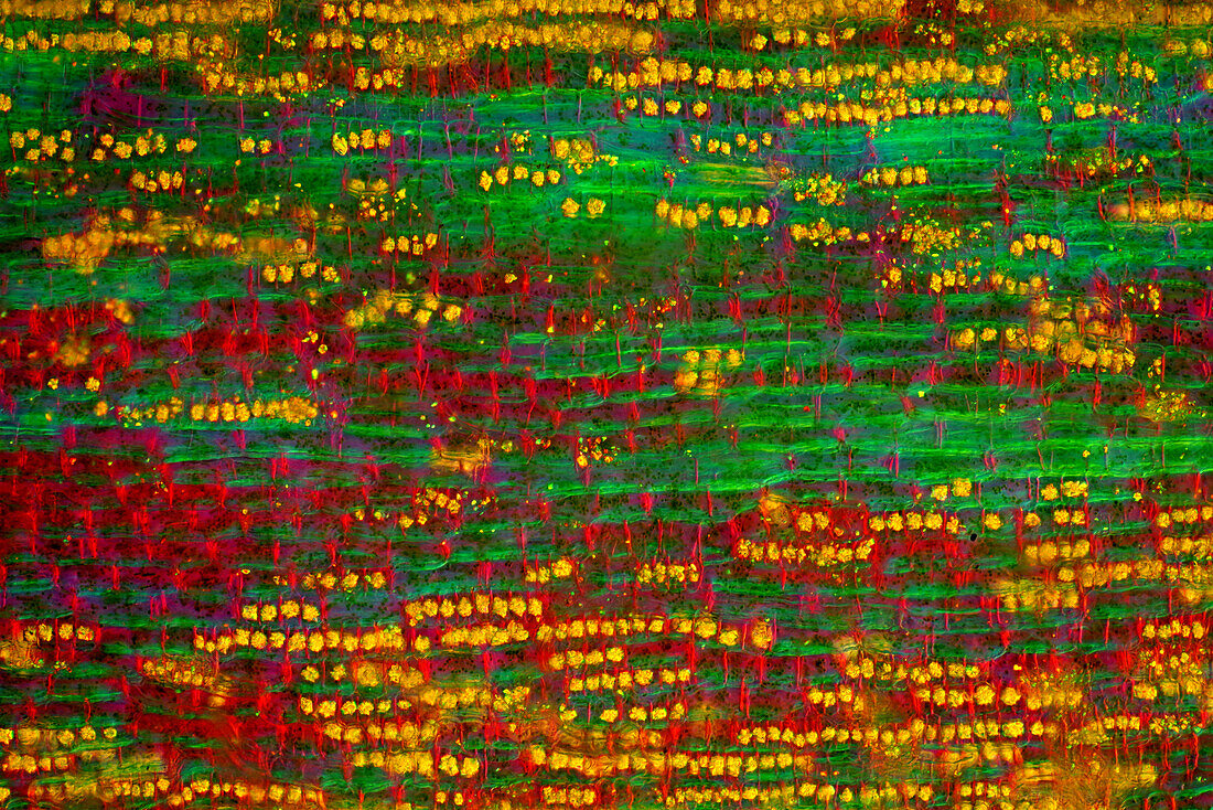 The image presents tissues in nettle stalk in longitudinal cross-section, photographed through the microscope in polarized light at a magnification of 100X. The round yellow structures are druses. Druses are the structures created by calcium oxalate.\n