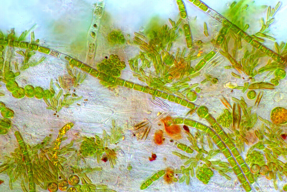 Das Bild zeigt verschiedene winzige Algen, die sich auf der Wurzel von Lemna sp. angesiedelt haben, aufgenommen durch das Mikroskop in polarisiertem Licht bei einer Vergrößerung von 200X