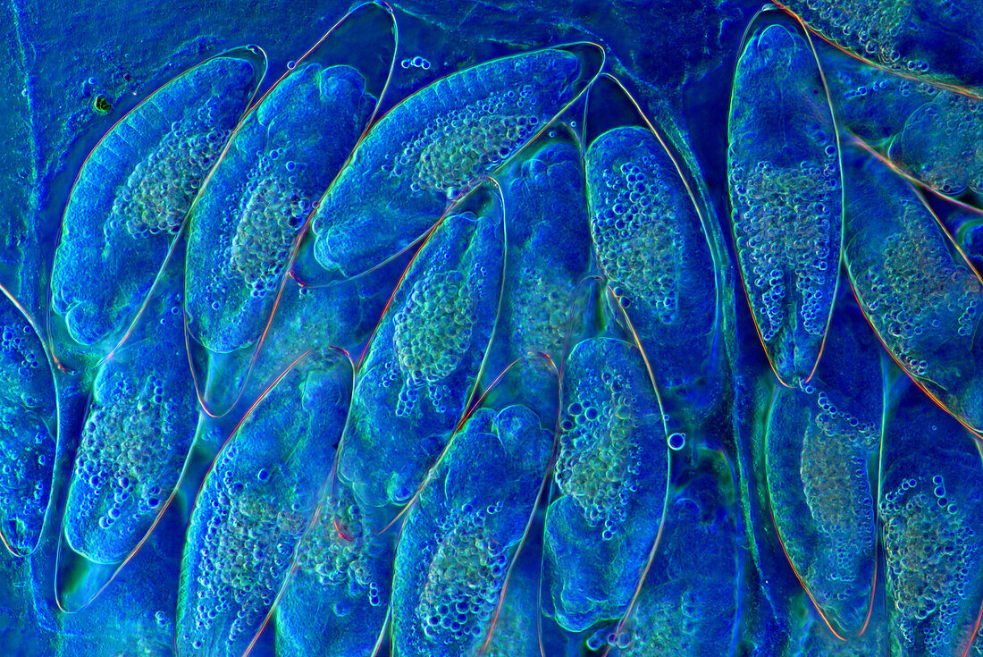 The image presents diptera eggs, photographed through the microscope in polarized light at a magnification of 100X\n