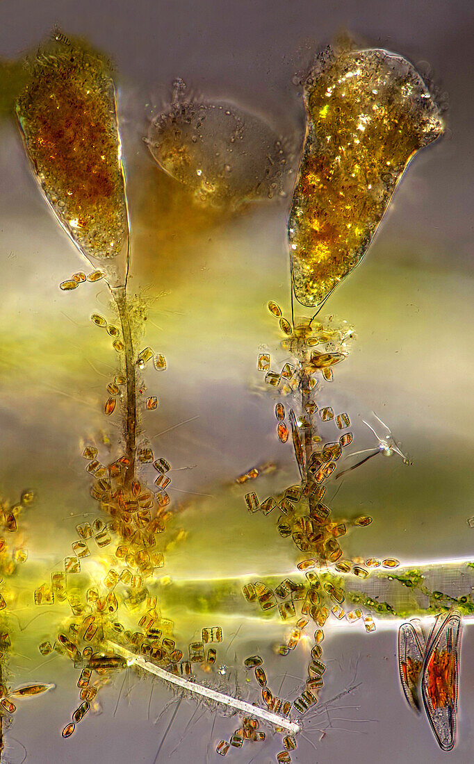 Das Bild zeigt zwei Suctorien (eine Art von Wimpertierchen) und winzige Kieselalgen, aufgenommen durch das Mikroskop in polarisiertem Licht bei einer Vergrößerung von 200X