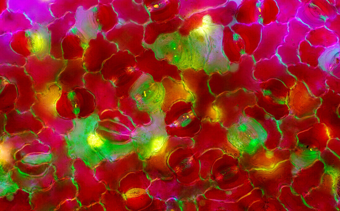 Das Bild zeigt Spaltöffnungen in der Blattepidermis von Croton, fotografiert durch das Mikroskop in polarisiertem Licht bei einer Vergrößerung von 200X