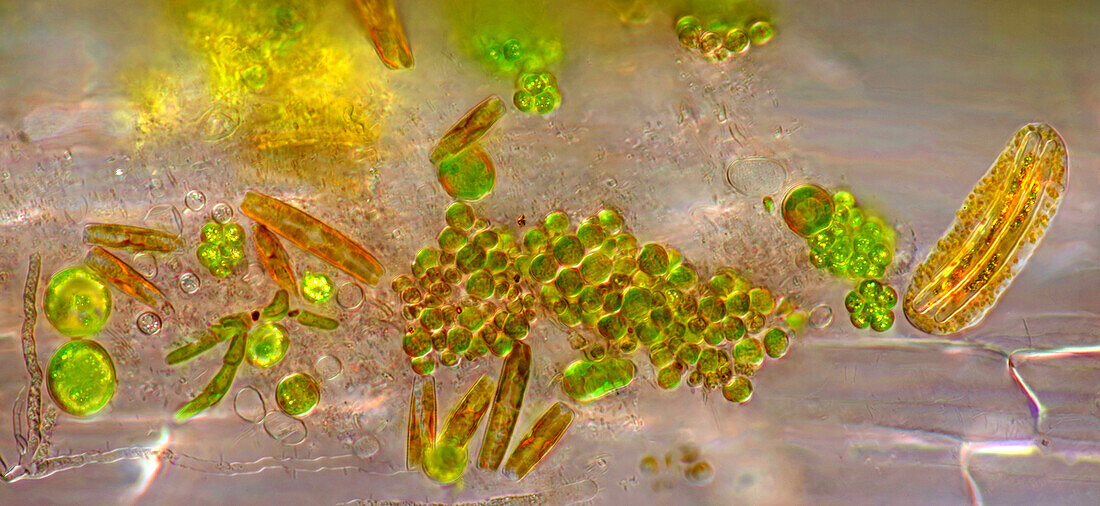 The image presents various tiny algae settled on Lemna sp. root, photographed through the microscope in polarized light at a magnification of 400X. On the right are visible diatoms closed in a special protecting case.\n