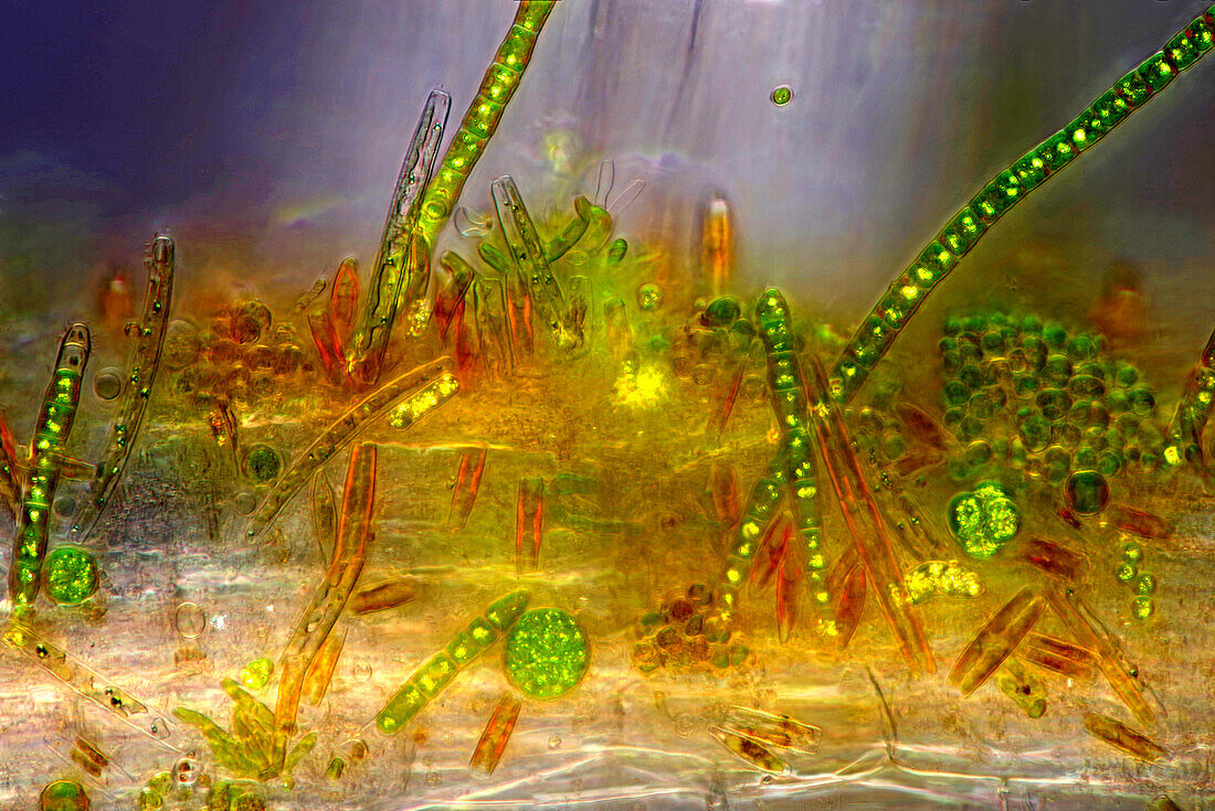 The image presents various tiny algae settled on Lemna sp. root, photographed through the microscope in polarized light at a magnification of 400X. On the right are visible diatoms closed in a special protecting case.\n