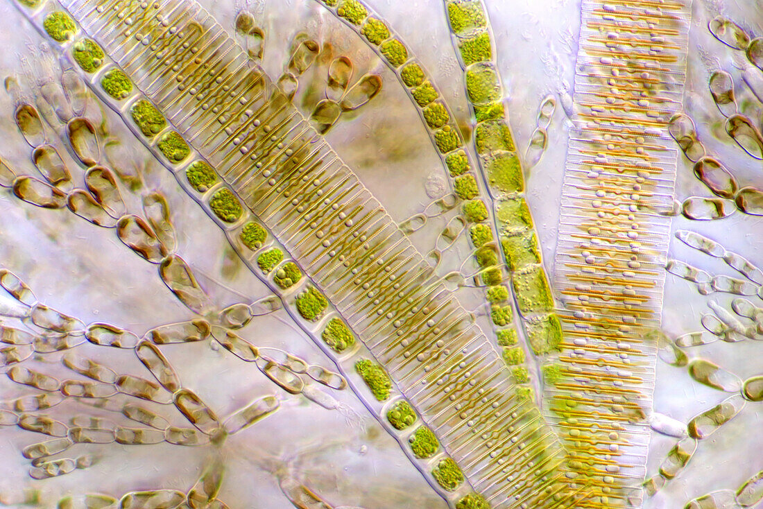 Das Bild zeigt verschiedene Algen (Fragilaria sp., eine Art von Kieselalgen, Batrachospermum sp., eine Art von Rotalgen und fadenförmige Grünalgen), die durch das Mikroskop in leicht polarisiertem Licht bei einer Vergrößerung von 200X fotografiert wurden