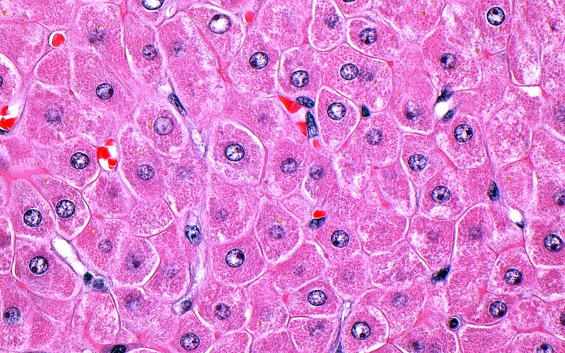 Liver cells, light micrograph