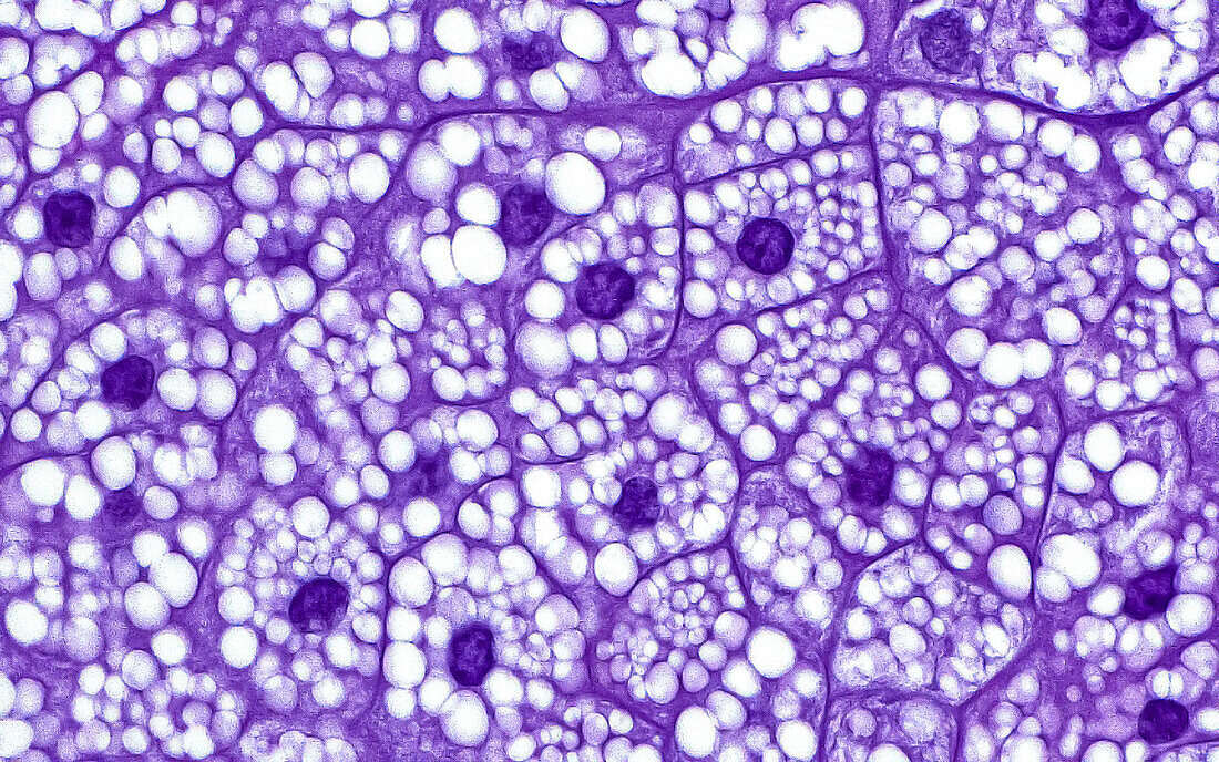 Sebaceous gland cells, light micrograph