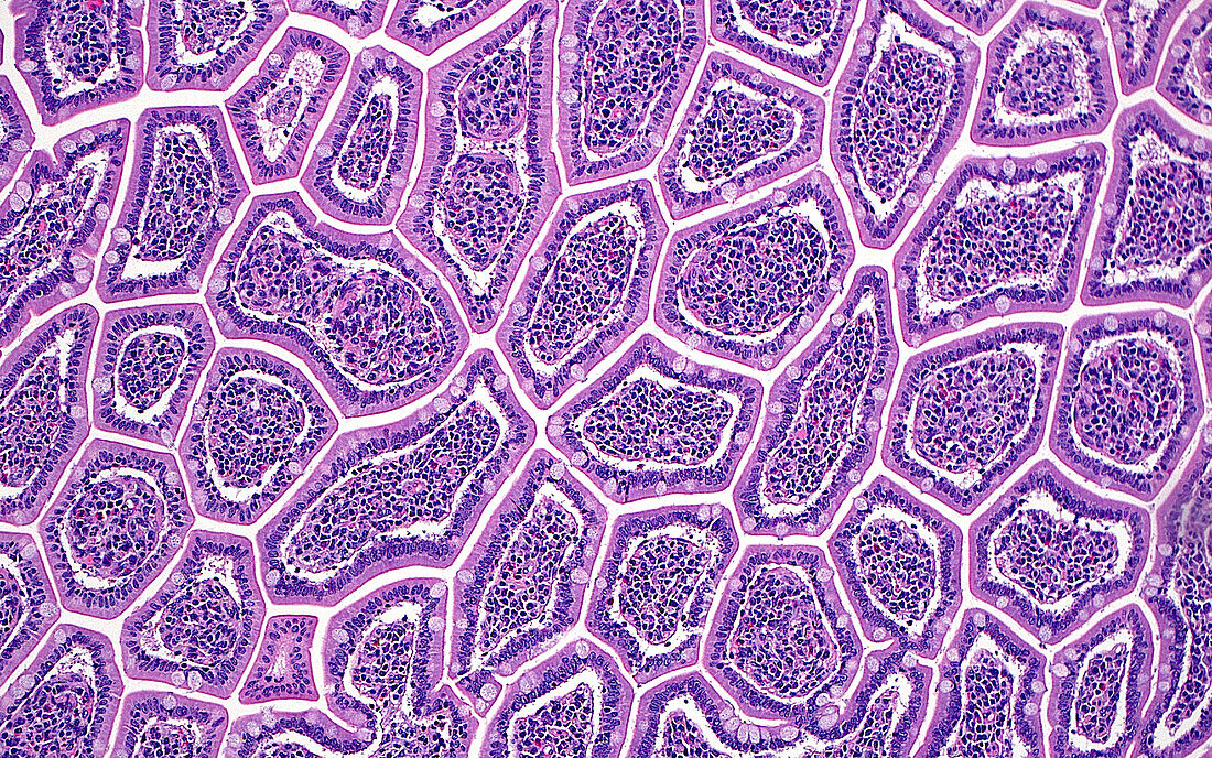 Small bowel villi, light micrograph