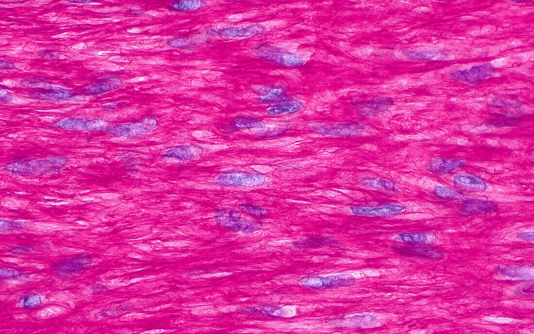 Intima kidney blood vessel, light micrograph