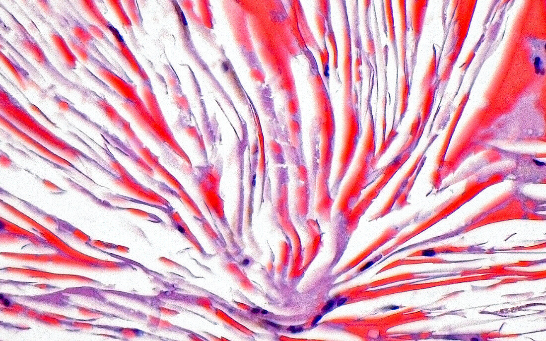 Cholesterol crystals, light micrograph