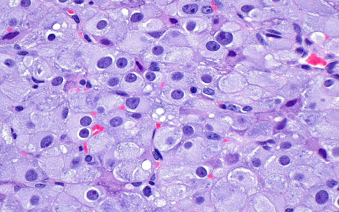Corpus luteum cyst cells, light micrograph