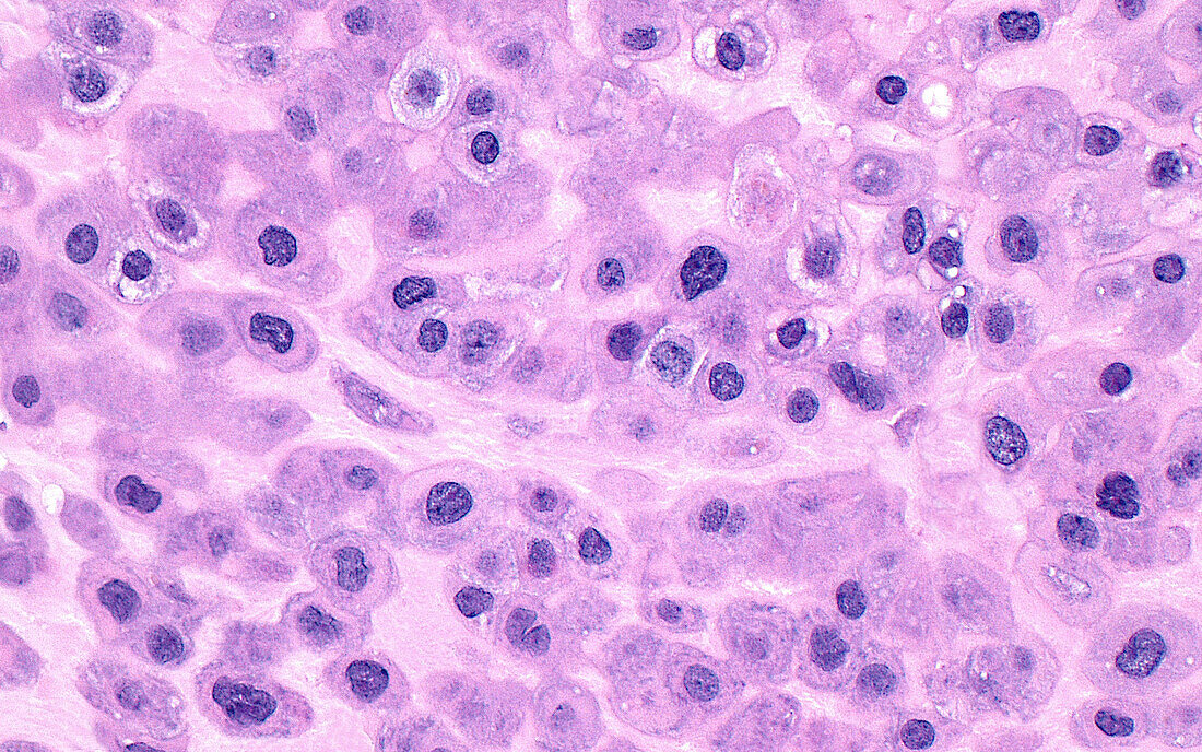 Uterus decidua cells, light micrograph