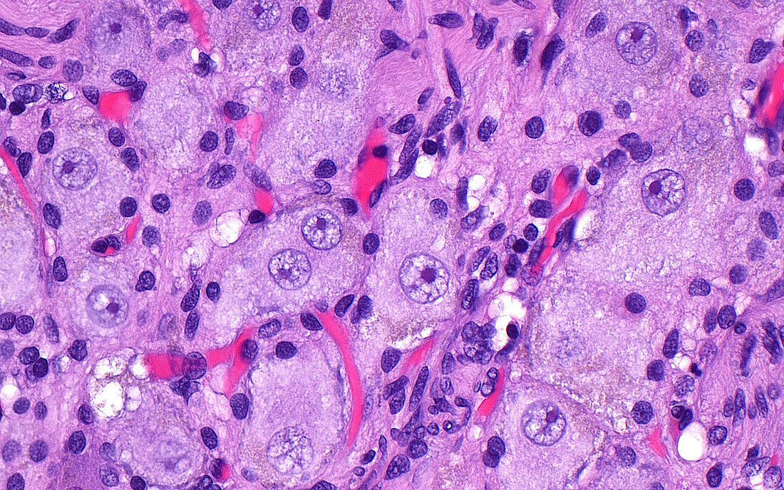 Ganglion cells, light micrograph
