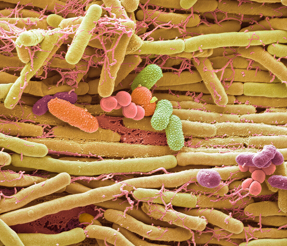 Mobile phone bacteria, SEM