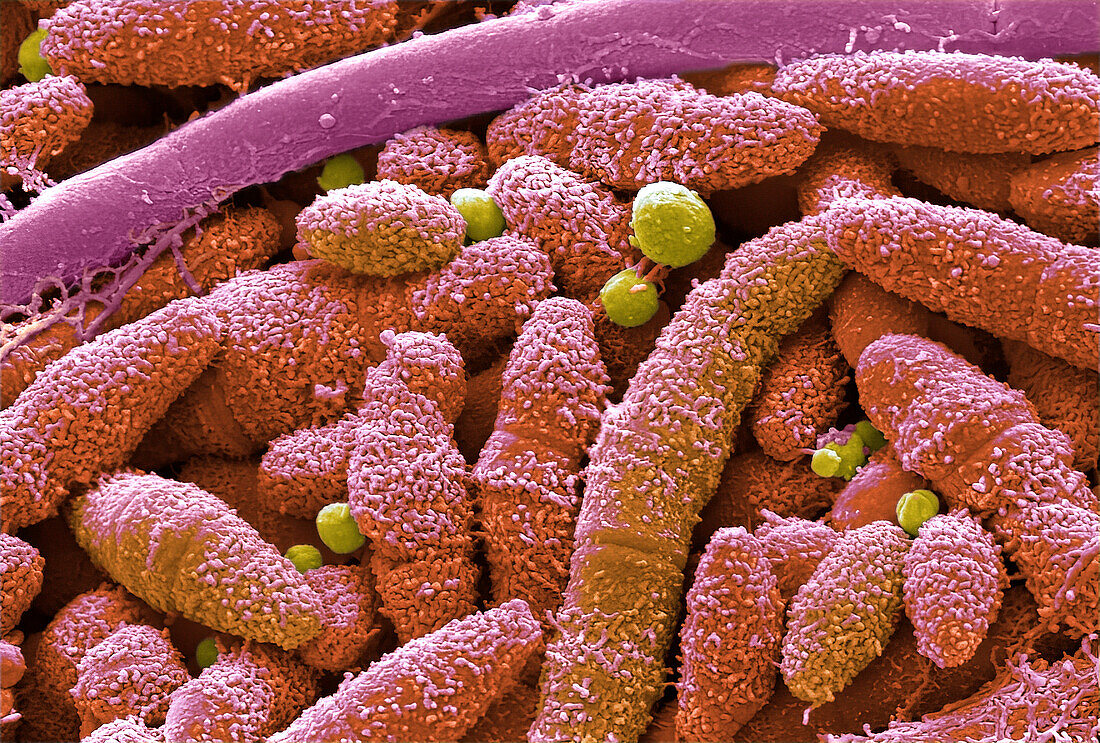 Tongue bacteria, SEM
