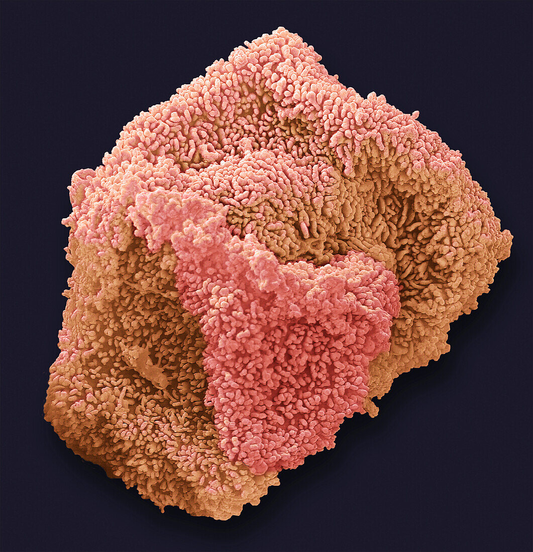 Prostate epithelial cell, SEM
