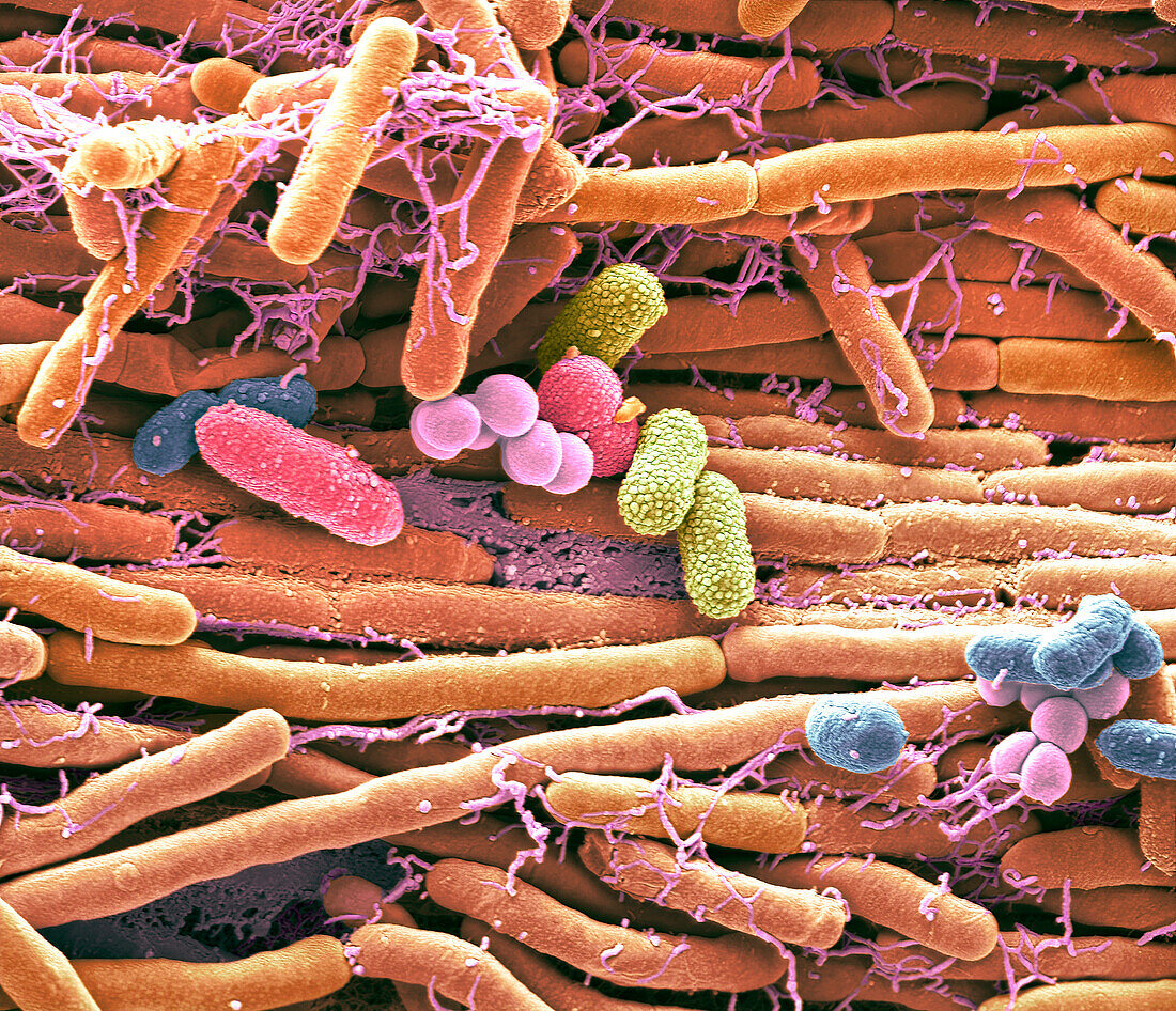 Mobile phone bacteria, SEM
