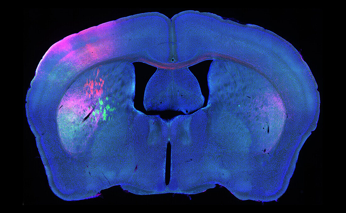 Mouse brain, fluorescent micrograph