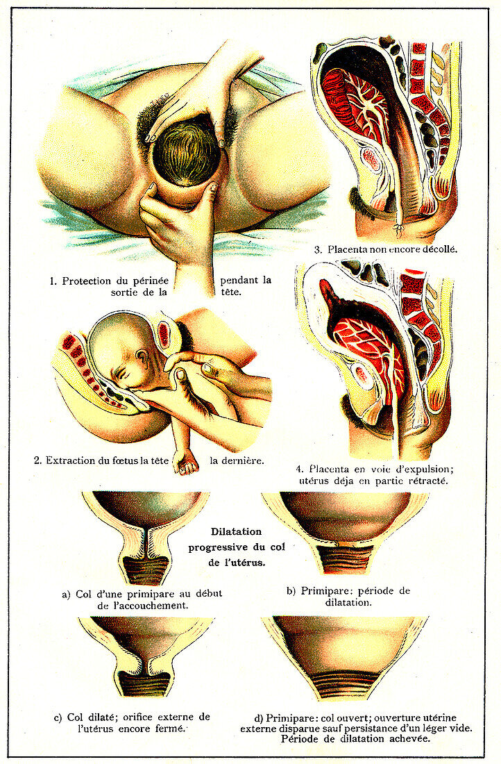 Childbirth, illustration