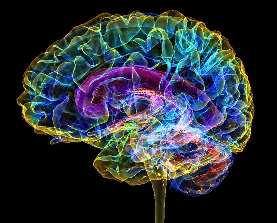 Human brain, 3D MRI scan