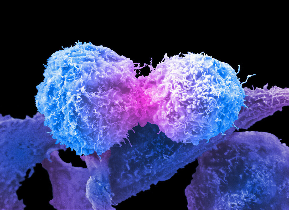 Prostate cancer cells dividing, SEM