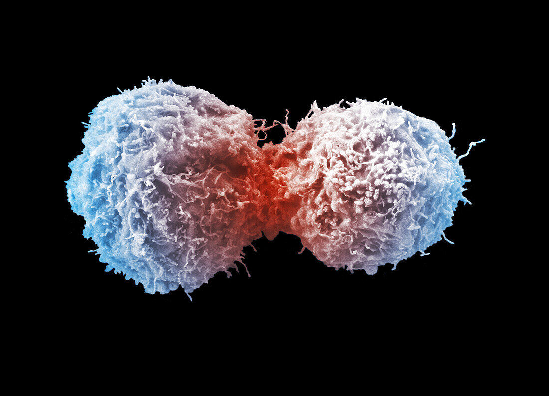 Prostate cancer cells dividing, SEM