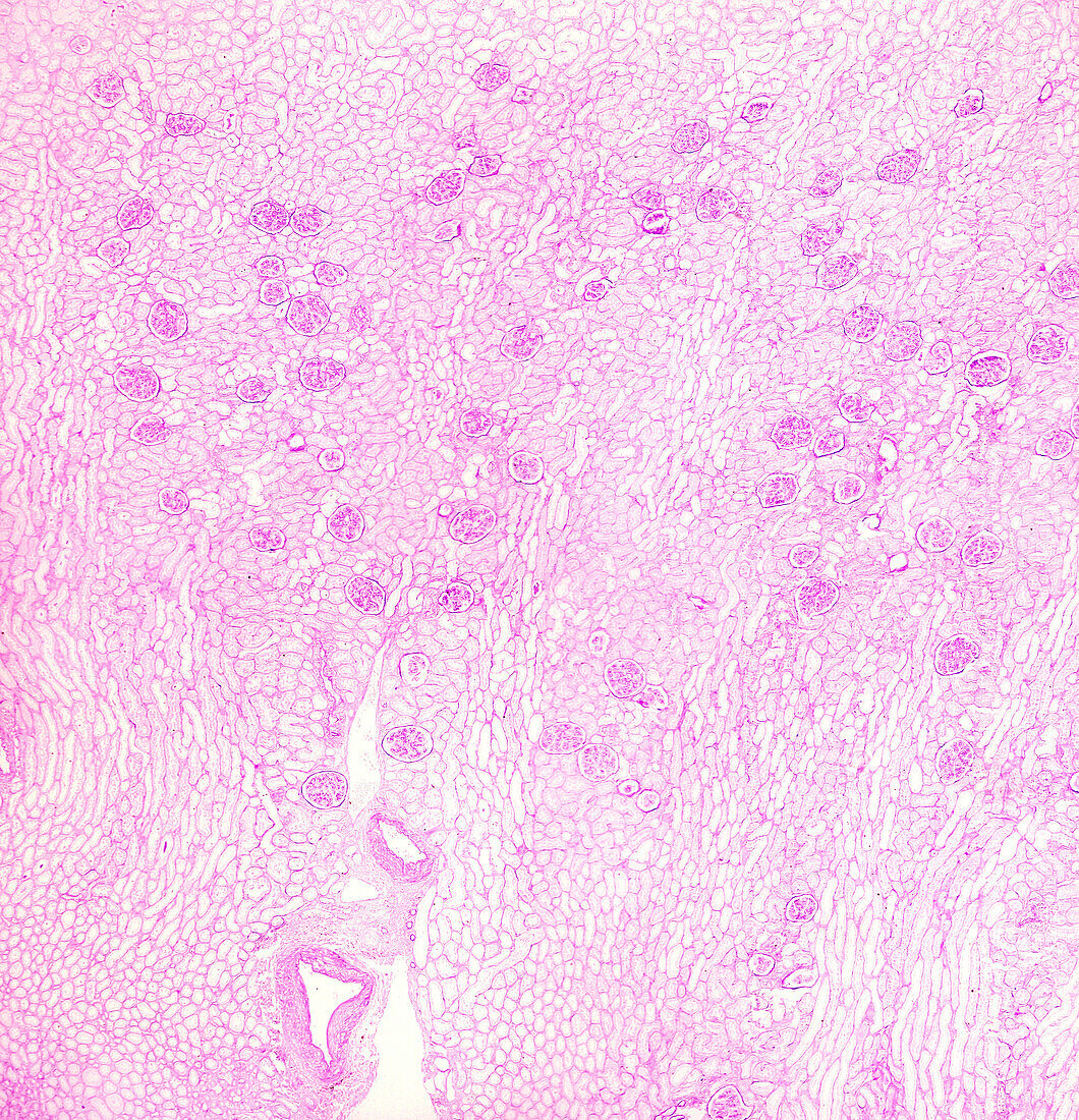 Human kidney, light micrograph
