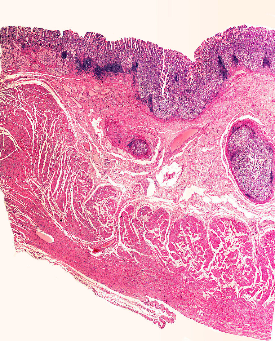 Human stomach pylorus, light micrograph