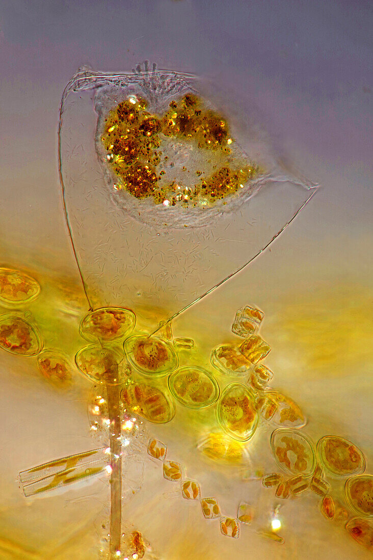 Suctoria and diatom algae, polarised light micrograph