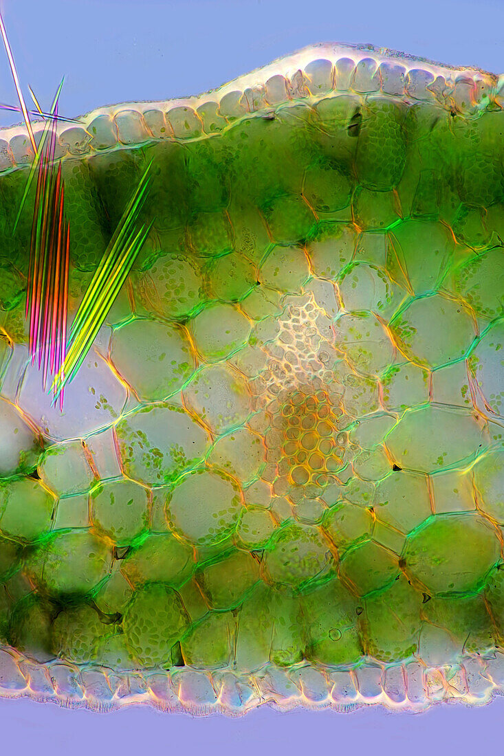 Hyacinth leaf with raphides, light micrograph