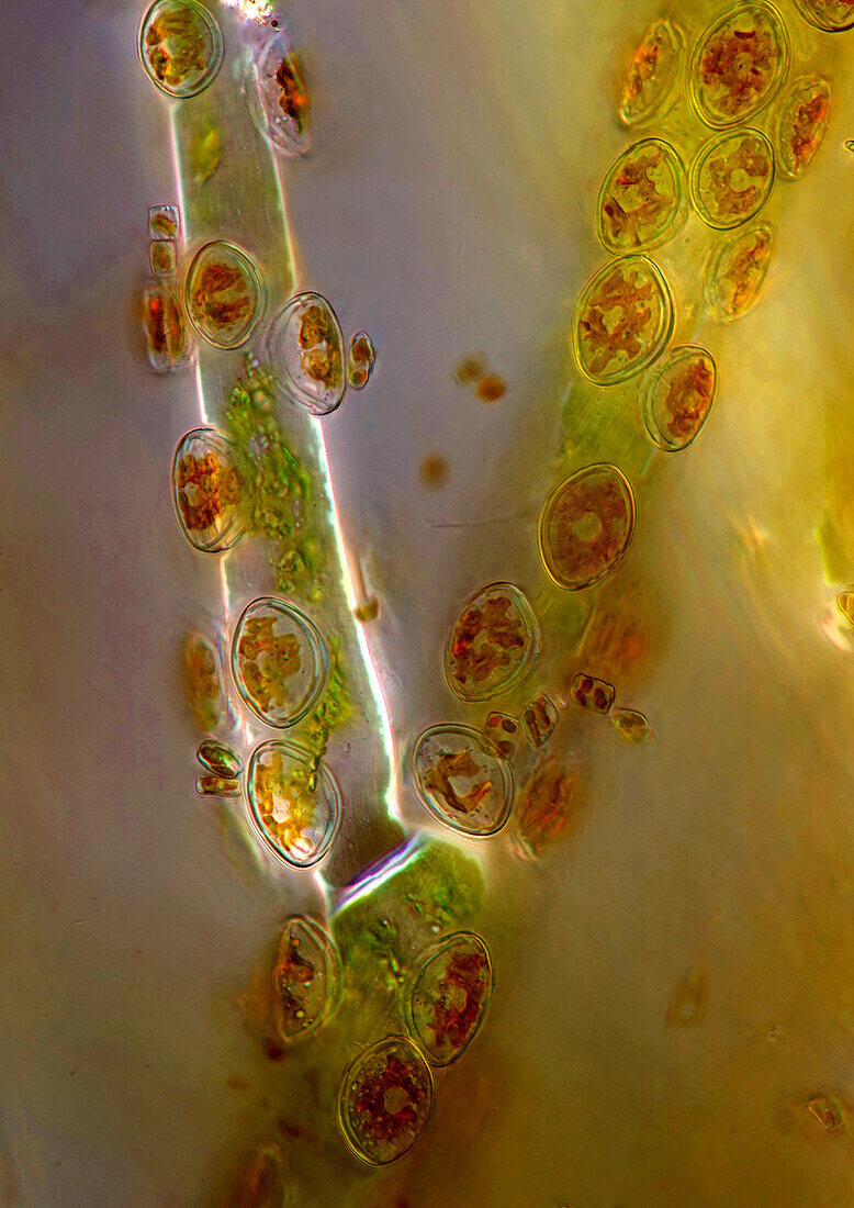 Cocconeis sp. algae, light micrograph