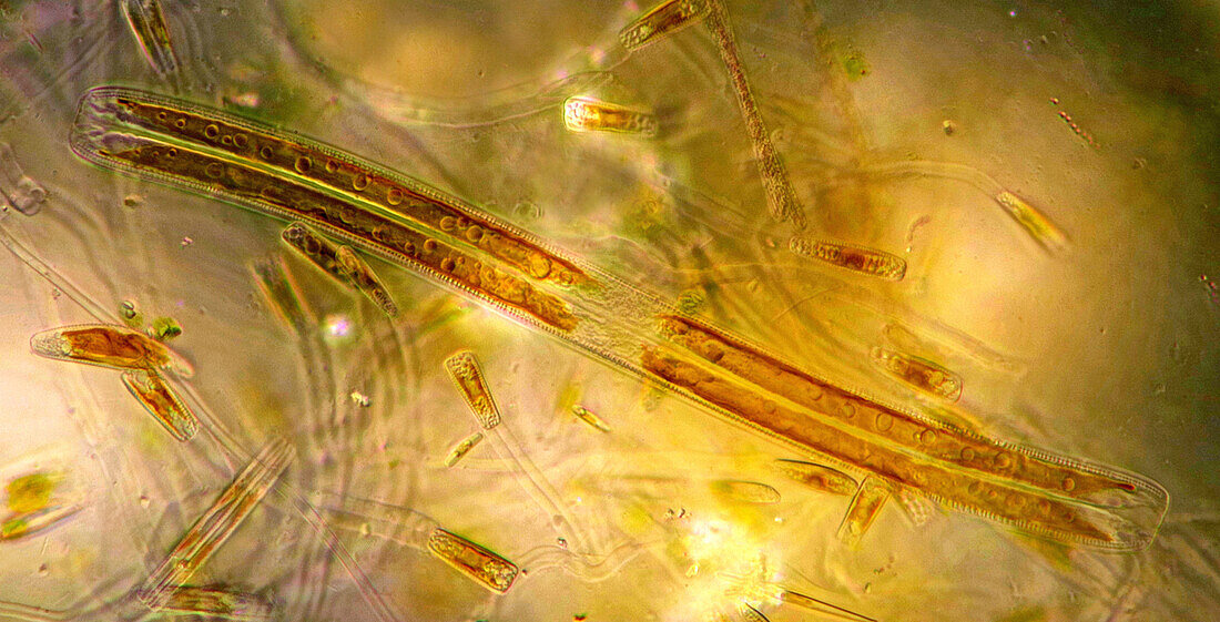 Nitzschia sigmoidea and gomphonema algae, light micrograph