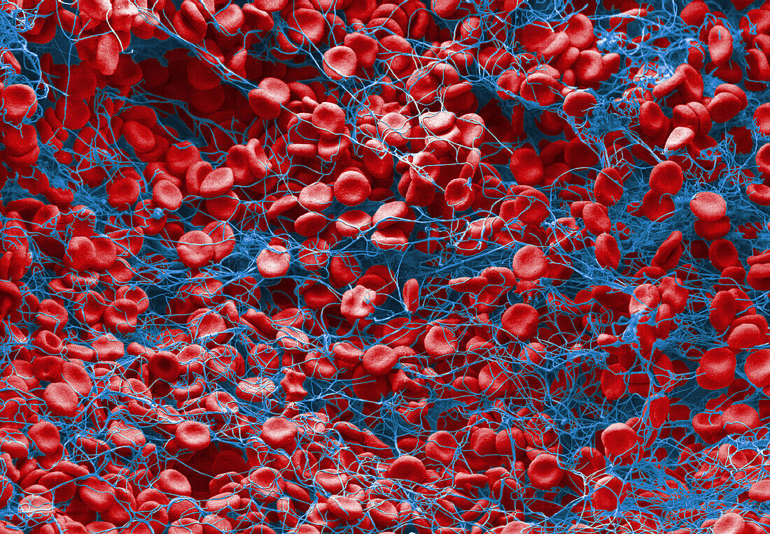 Red blood cells forming clot, SEM