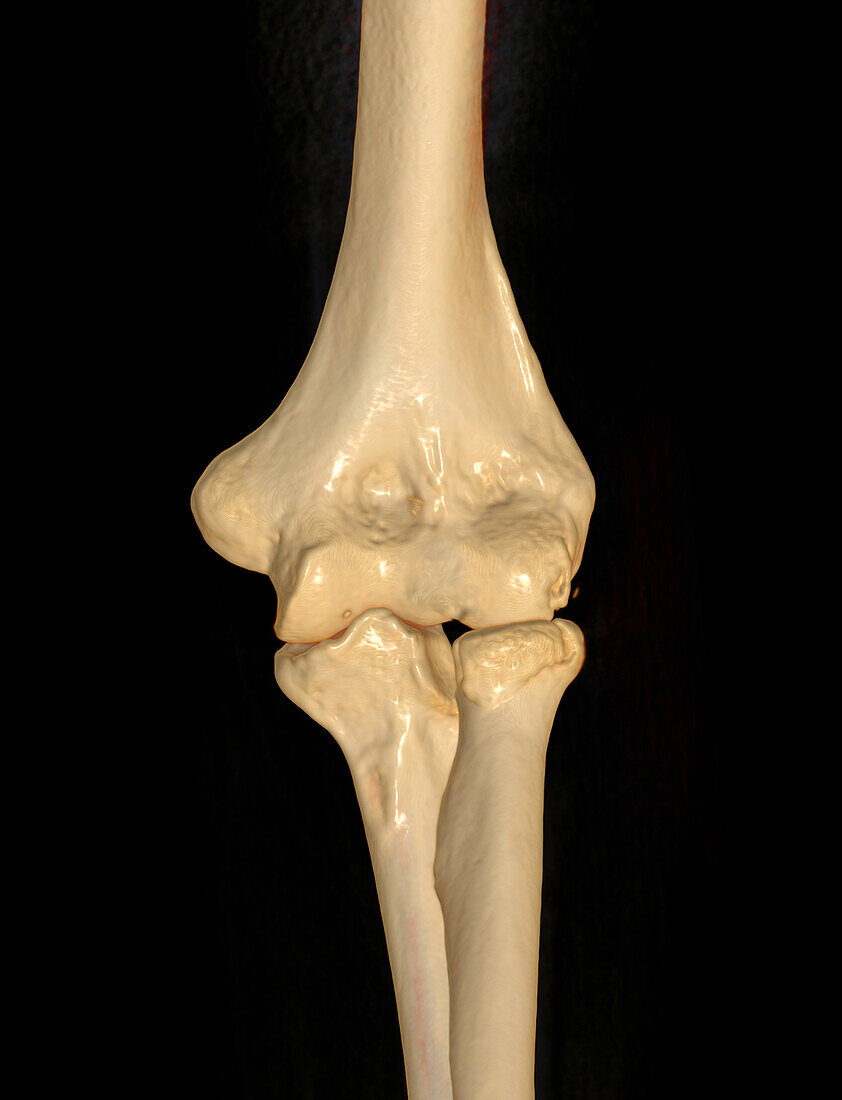 Healthy elbow joint, CT scan