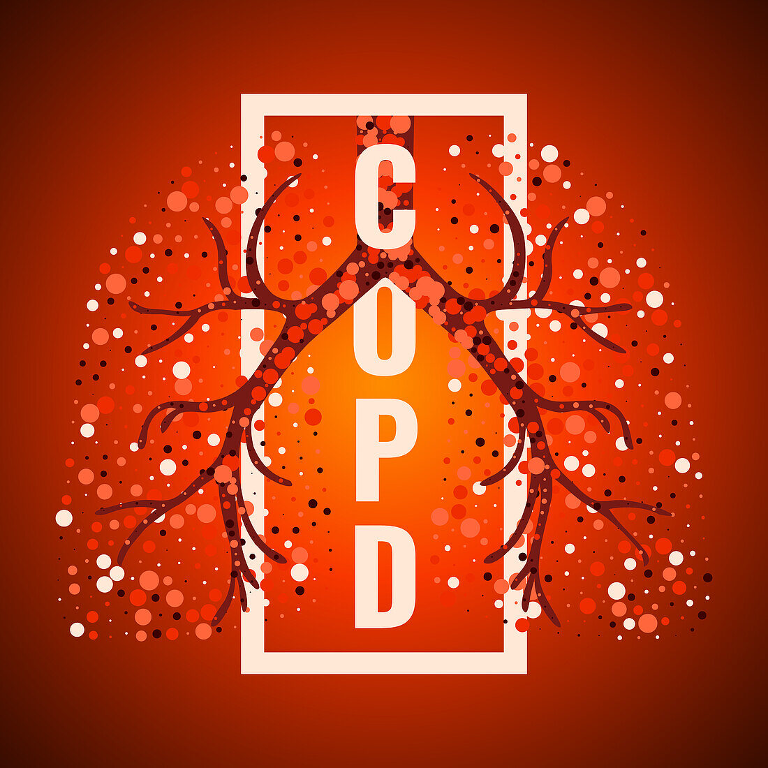 COPD, conceptual illustration