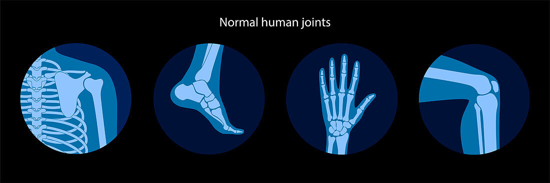 Healthy joints, illustration