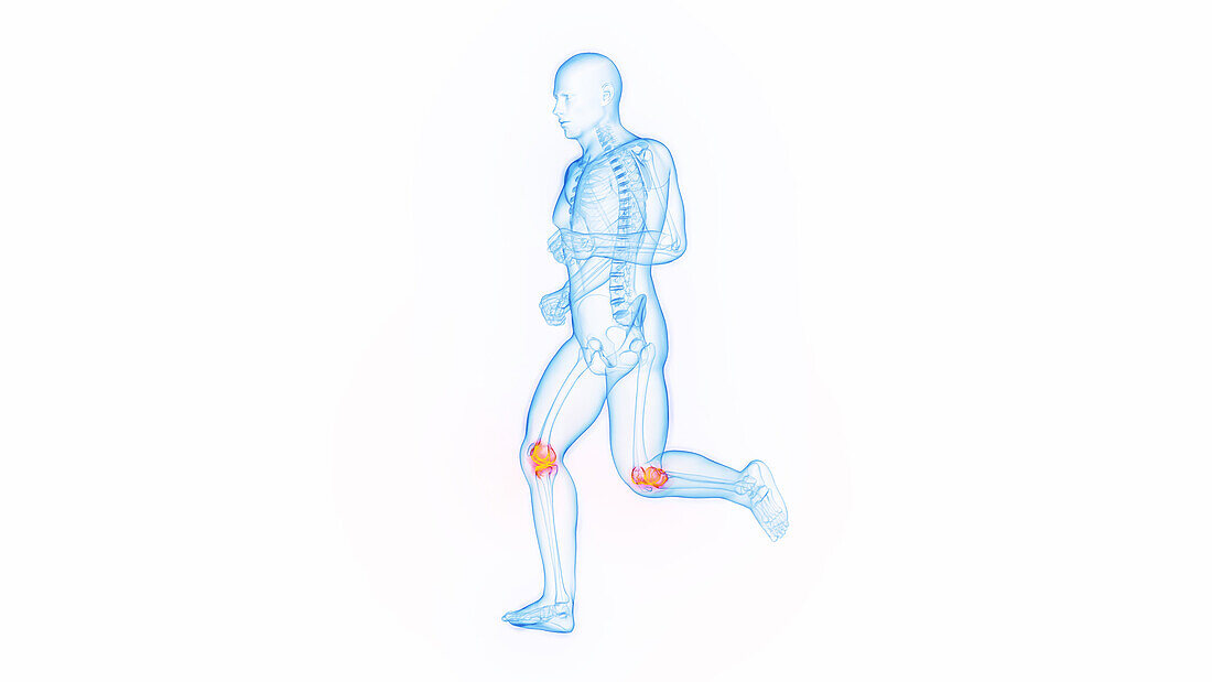 Knee pain while jogging, illustration