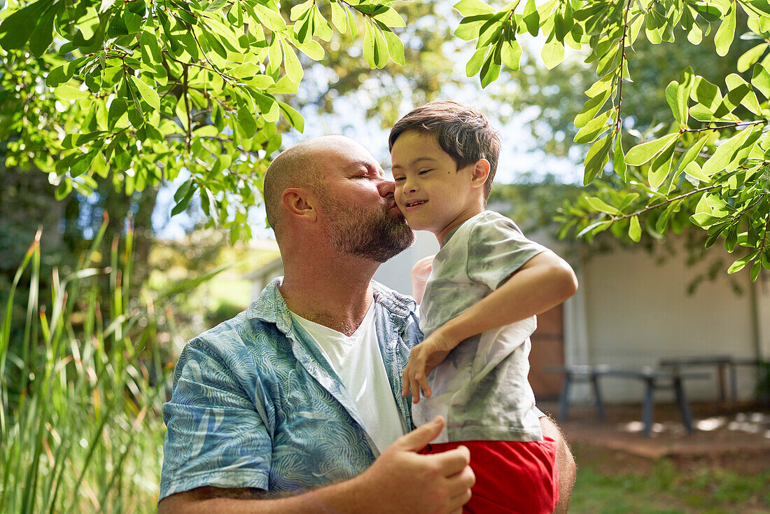 Father kissing son with Down syndrome in summer backyard