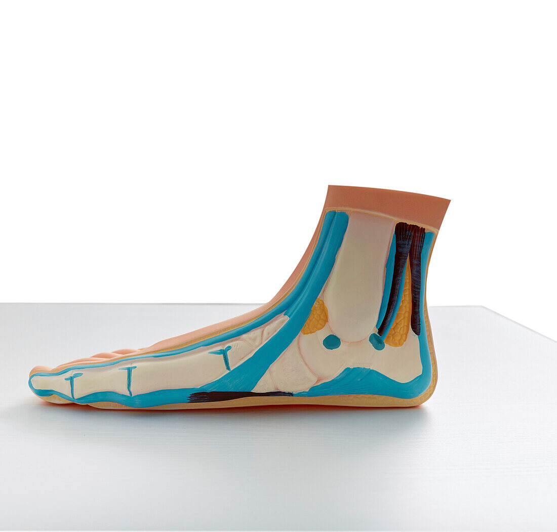 Flatfoot anatomical model