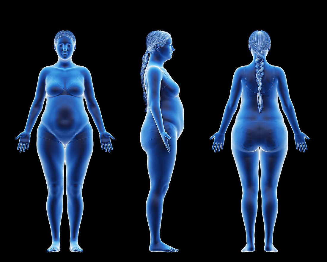 Overweight female body, illustration