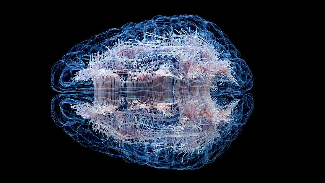 Brain white matter fibres, illustration