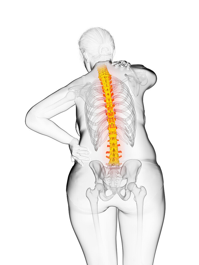 Overweight woman with painful back, illustration