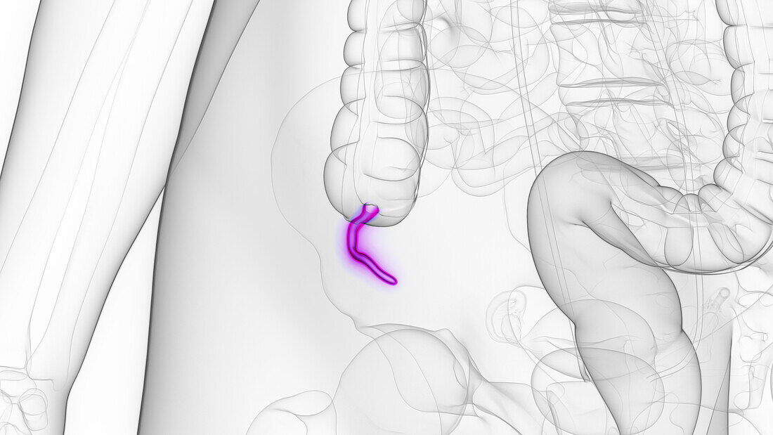 Female appendix, illustration
