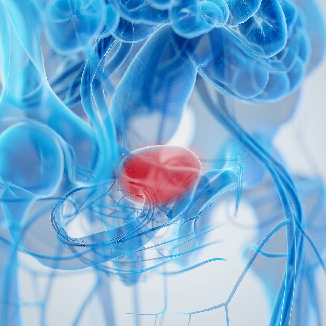 Inflamed bladder, illustration