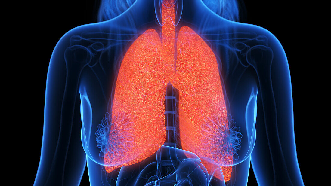 Inflamed lung, illustration