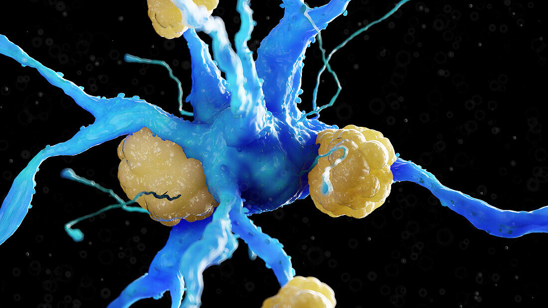 Nerve cell with amyloid plaques, illustration