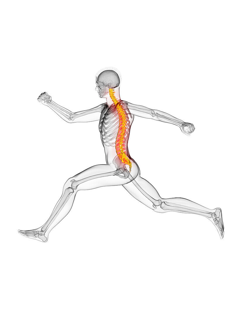 Runner's painful back, illustration