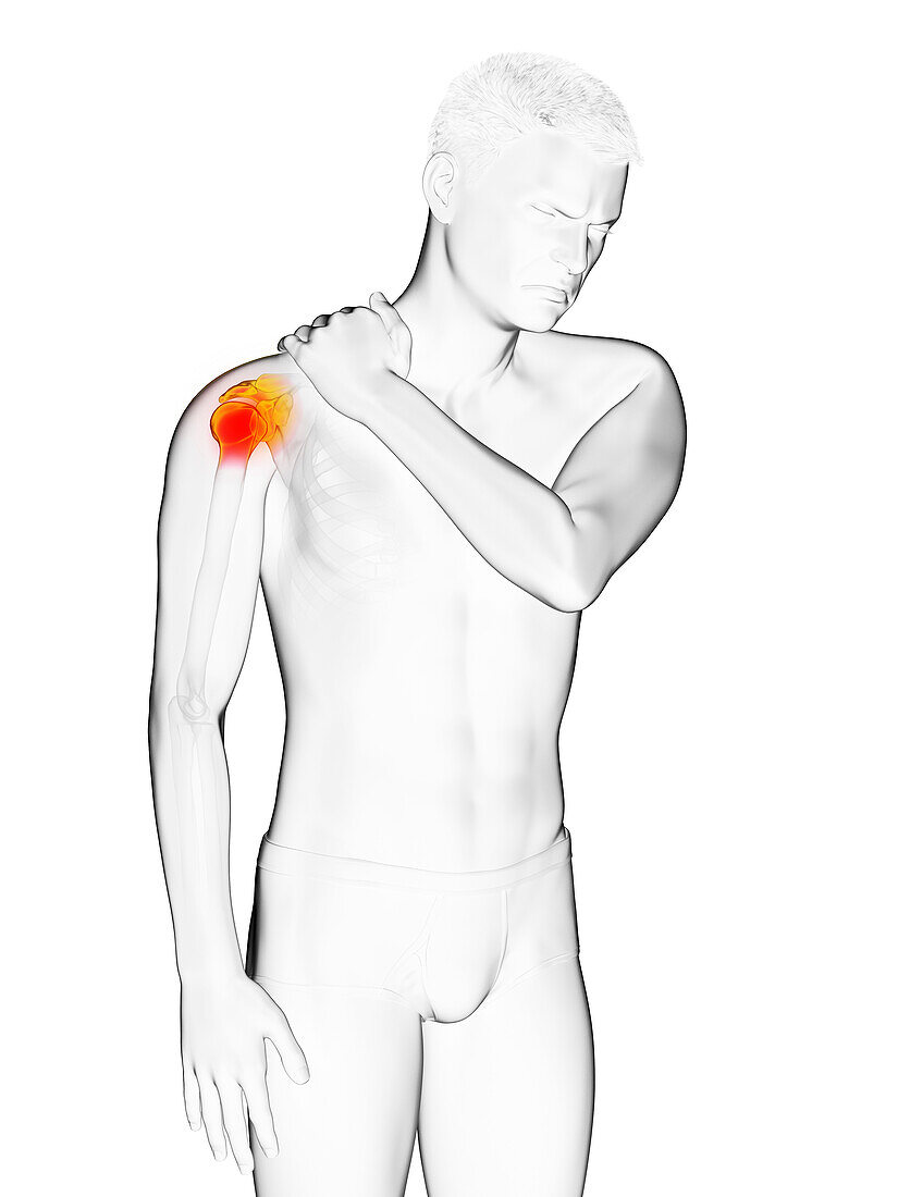 Man with a painful shoulder, illustration